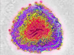6 morts en Chine: Un mystérieux virus qui inquiète 6 morts en Chine: Un mystérieux virus qui inquiète