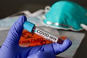 952 nouveaux cas de coronavirus au Québec ce vendredi 952 nouveaux cas de coronavirus au Québec ce vendredi