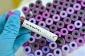 COVID-19: LE MEILLEUR BILAN DEPUIS SEPTEMBRE COVID-19: LE MEILLEUR BILAN DEPUIS SEPTEMBRE
